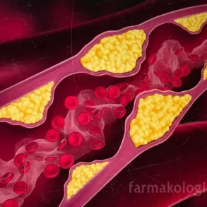 Απεικόνιση αθηρωματικής πλάκας που δημιουργεί η χοληστερίνη στα τοιχώματα των αρτηριών.